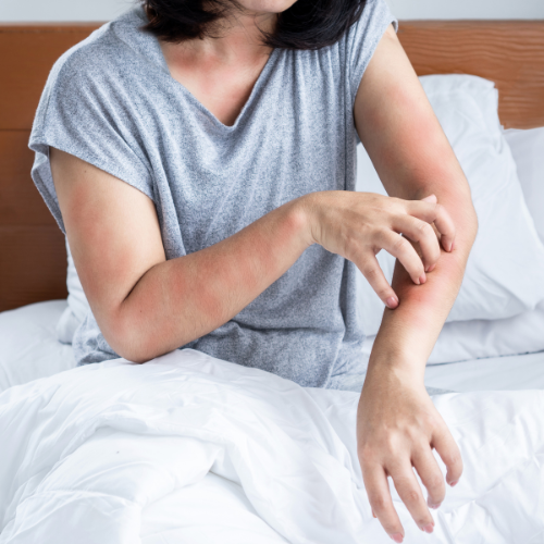 Czingerhome GREENFIRST® Anti Bed Bug - Matrachuzat cipzáras, levehető (ágyi poloska ellen)