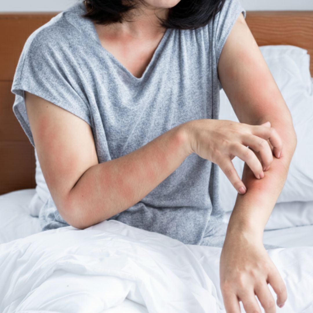 Czingerhome GREENFIRST® Anti Bed Bug - Matrachuzat cipzáras, levehető (ágyi poloska ellen)